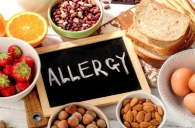 Rimedi naturali per le allergie alimentari