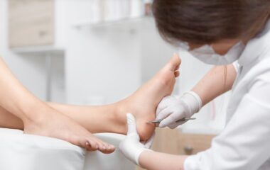 La guida facile ai migliori rimedi naturali per i calli e i duroni dei piedi