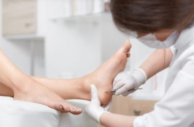 I migliori rimedi naturali per i calli e i duroni dei piedi: la guida facile