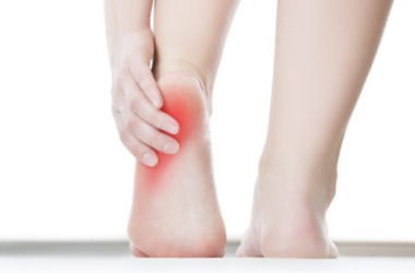 Come prevenire e curare la tallonite anche con rimedi naturali