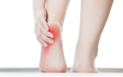 Come prevenire e curare la tallonite anche con rimedi naturali