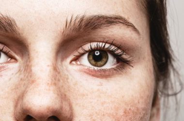 Congiuntivite: come curarla con rimedi naturali