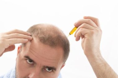 Scopriamo l’importanza di una corretta alimentazione per l’alopecia