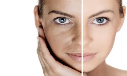Pelle grassa e oleosa rimedi naturali