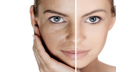 Pelle grassa e oleosa rimedi naturali