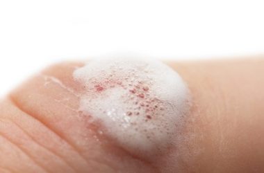 Acqua ossigenata usi alternativi e proprietà