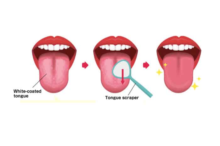 Pulizia della lingua