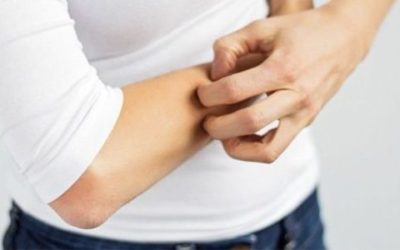 Pappataci: rimedi naturali contro questi insetti