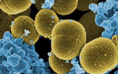 Stafilococco: che cos’è e come curarsi?