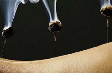 Moxa: come funziona e quali benefici