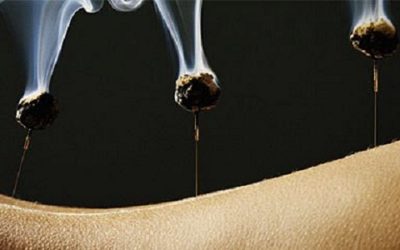 Moxa: come funziona e quali benefici