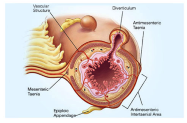 Quello che c’è da sapere sui diverticoli: sintomi, diagnosi e trattamento