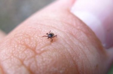 Malattia di Lyme, sintomi e cure