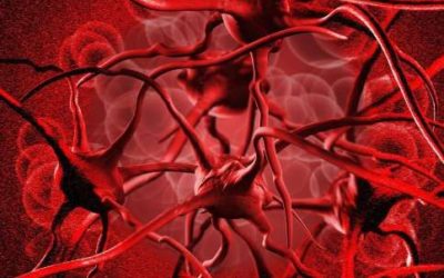 Anemia, come riconoscerla e curarla