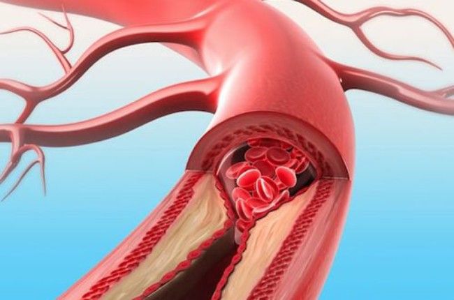 Risultati immagini per vitamina k2 alimenti