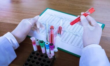 Azotemia, di cosa si tratta e come curarla