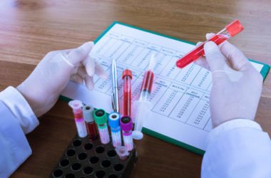 Azotemia, di cosa si tratta e come curarla