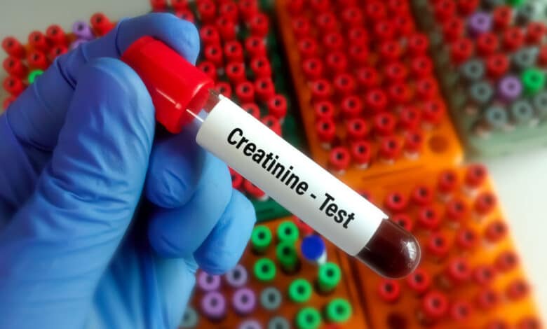 creatinina alta e bassa