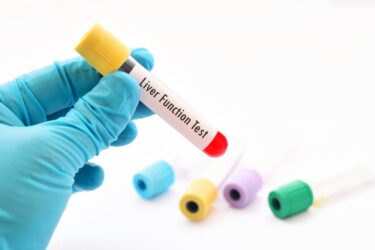 Bilirubina: valori fisiologici, sintomi, cause e rimedi