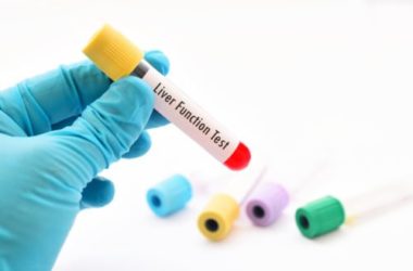 Bilirubina: valori fisiologici, sintomi, cause e rimedi