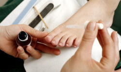 Unghie incarnite: come curarle in modo naturale