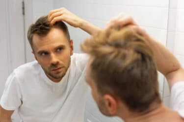 Caduta dei capelli: rimedi naturali calvizie uomo e donna