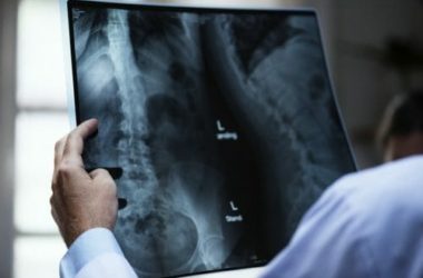 Fluoro: un oligoelemento essenziale, da conoscere meglio