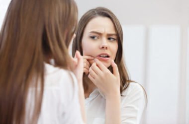 Acne giovanile rimedi naturali e prevenzione: 9 suggerimenti
