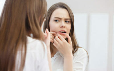 Acne giovanile rimedi naturali e prevenzione: 9 suggerimenti