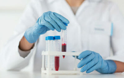 Ferro alto nel sangue: la dieta corretta per tornare in equilibrio