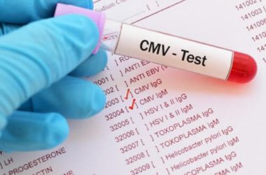 Citomegalovirus: pericoloso soprattutto per le donne in gravidanza, scopriamo i suoi sintomi e che terapie fare in caso di infezione