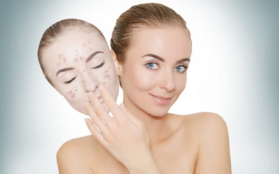 I trucchi e i rimedi naturali per togliere i punti neri: alcune ricette da provare