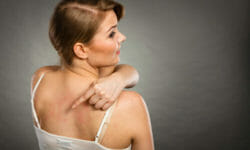 Orticaria: come curarla e prevenirla in modo naturale