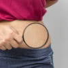 Come prevenire le smagliature o attenuarne l’effetto? Ecco quali sono i migliori sistemi naturali