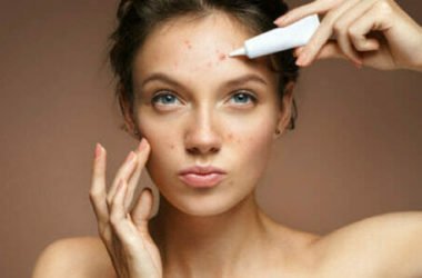 Tutto sui brufoli: quali sono le cause e come curarli naturalmente