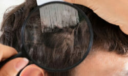 Lenire i disturbi della psoriasi in modo naturale: ecco i migliori sistemi
