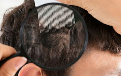 Lenire i disturbi della psoriasi in modo naturale: ecco i migliori sistemi