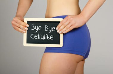 Quali sono i migliori rimedi naturali per la cellulite? Tutti i nostri suggerimenti