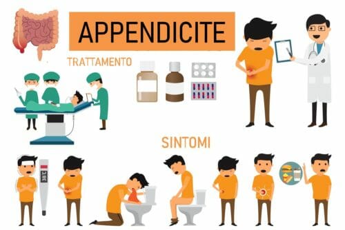 Appendicite: come riconoscere i sintomi iniziali e cure possibili
