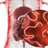 Vermi intestinali: sono parassiti che possiamo prevenire e curare con facilità