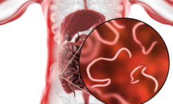 Vermi intestinali: sono parassiti che possiamo prevenire e curare con facilità