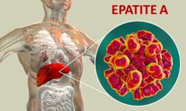 Tutto sull’epatite A: quali sono i sintomi, quali precauzioni prendere e i rimedi per guarire