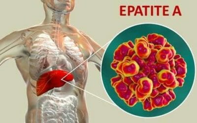 Tutto sull’epatite A: quali sono i sintomi, quali precauzioni prendere e i rimedi per guarire