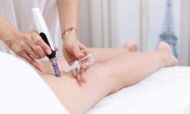 Tutto sulla mesoterapia, in cui si iniettano farmaci direttamente sottopelle: quali i benefici, come si esegue e quali sono i risultati