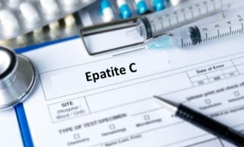 Tutto sull’epatite C: scopriamo il virus HCV che si trasmette con il sangue, è asintomatico e cronico