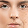 Il collagene è la proteina strutturale del corpo umano, scopriamo a cosa serve e come diminuirne la naturale perdita