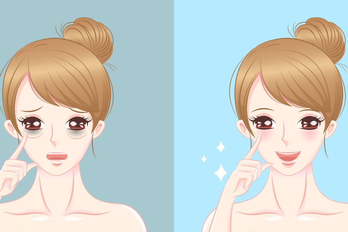 borse sotto gli occhi 