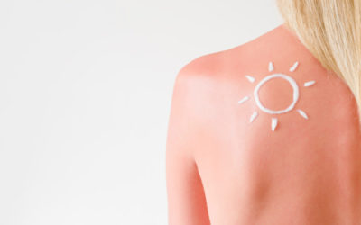 Le ricette di doposole naturale fai da te, per il viso e per il corpo