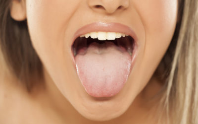 Lingua bianca? Ecco quali sono le cause più frequenti e i rimedi naturali consigliati