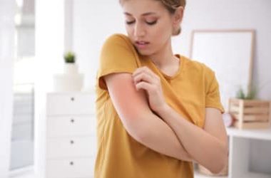 Allergia al nichel: cause, sintomi e rimedi anche naturali per alleviare il fastidio